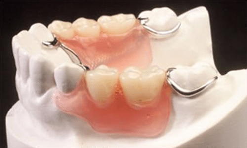 Partial Dentures