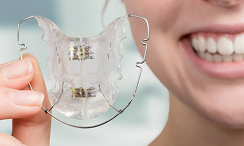 Orthodontic Appliances and Retainers